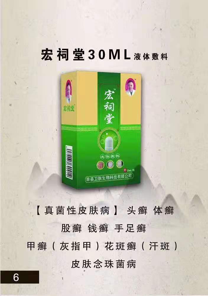 宏祠堂30ML液体敷料（真菌性皮肤病）头癣，体癣，手足癣，灰指甲，花斑癣，皮肤念珠菌病